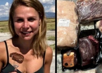Πρώην vegan έπαθε σπάνια πάθηση και τώρα τρώει 2 κιλά κρέας τη μέρα